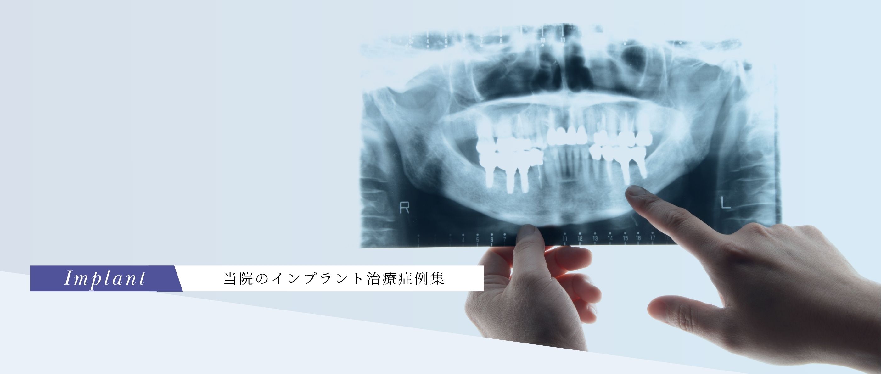 キービジュアル